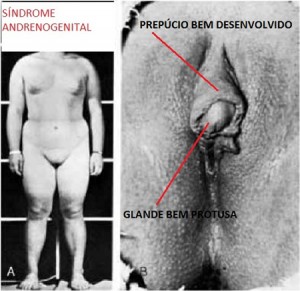 anatomia-vagina-45